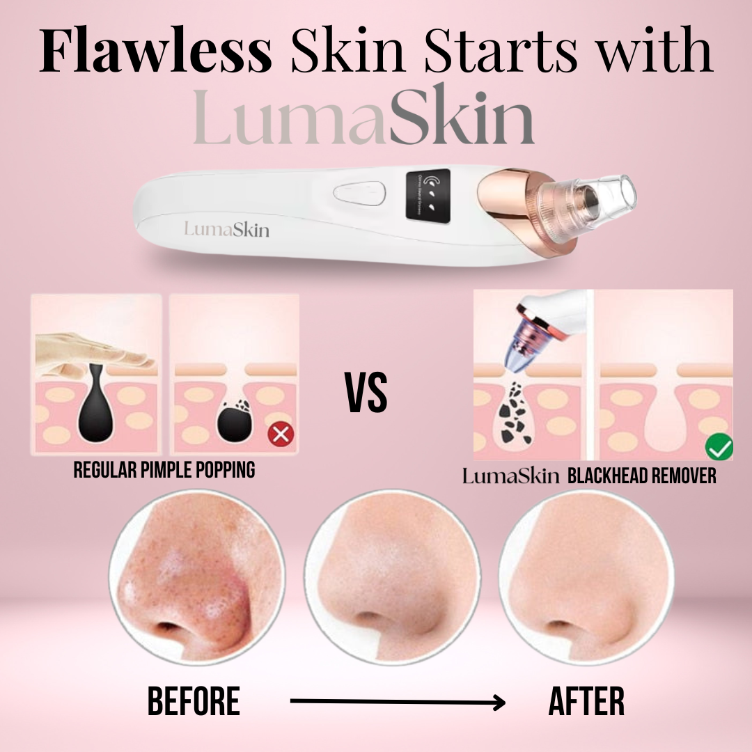 LumaSkin Blackhead Remover